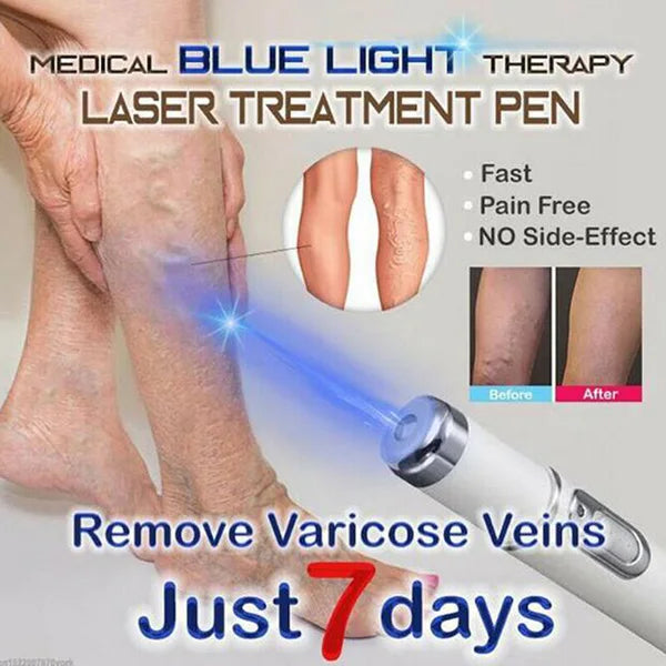 Stylo Laser Anti-acné et Anti-rides